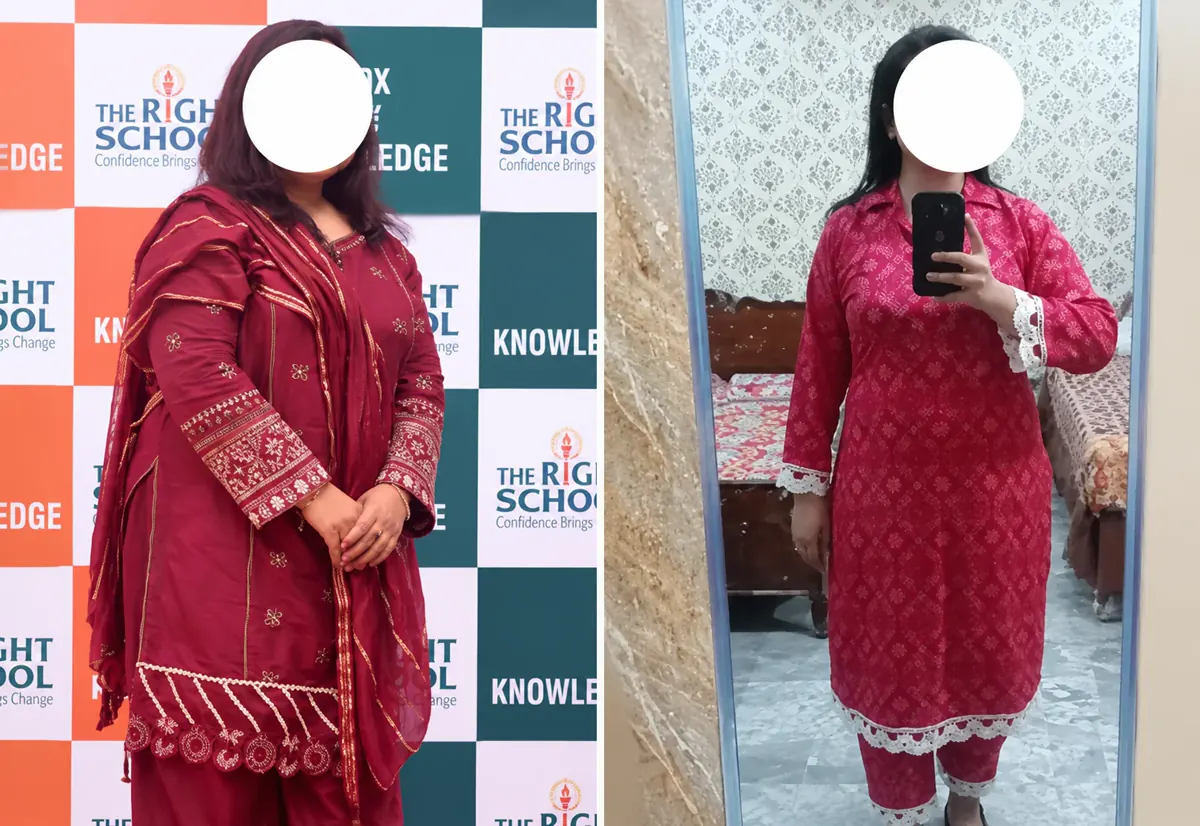 Before and after photos of a woman in shalwar kameez after weight loss, face hidden for privacy